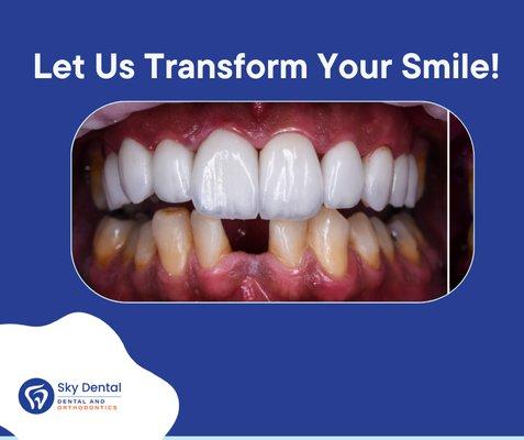 Sky Dental Chandler: Transforming Smiles, Changing Lives!