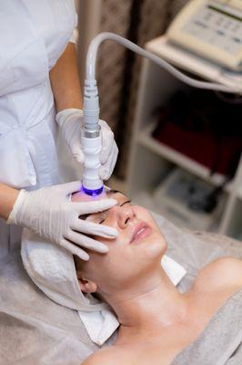 CryoSkin Facial