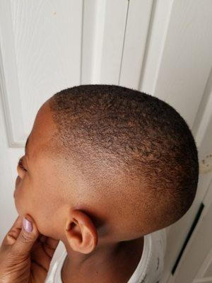 Bald fade