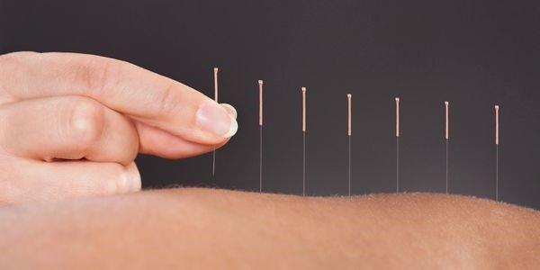 Accupuncture QCA Chiropractors Dr Jennifer Devens Bettenforf, IA