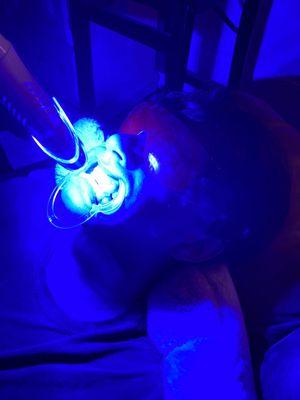 How does it work?
use the combination of an LED light and teeth whitening gel. 90 min session.