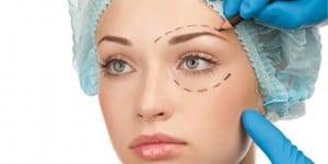 Eyelift surgery