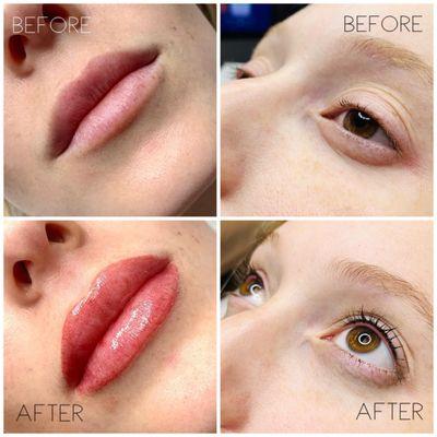 This client wanted to enhance her lash line and lips. Photo is immediately after procedure