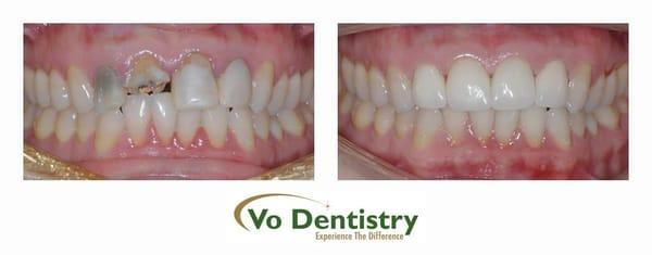 Cosmetic Dentistry