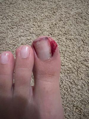 My toe with dried blood and it was still bleeding after I got home. So disappointing.