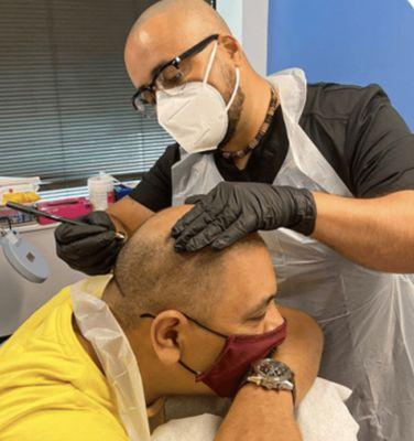 Scalp micropigmentation for men's hair loss. Before and after treatments by Ruben F. Diaz in Bethesda, Maryland.