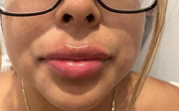 Labios voluminosos y hermosos!!