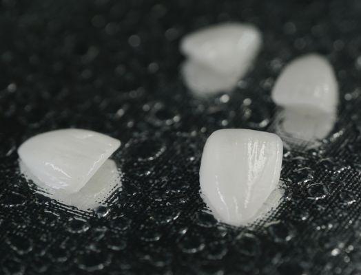 Porcelain Veneers