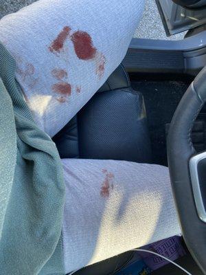 the blood on my pants after a 10 minute car ride to the vet