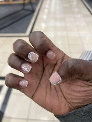 Ugly nails