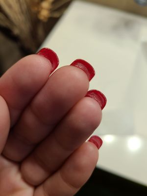 Glue under the nail