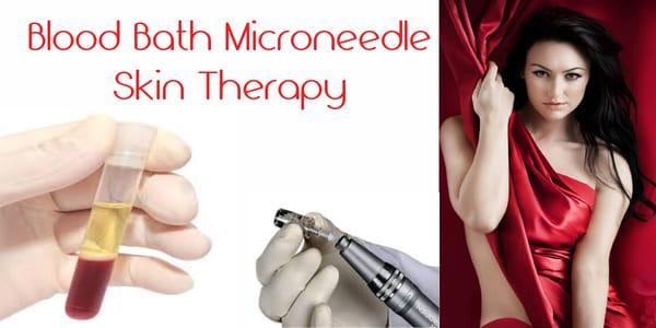 Blood Bath PRP Micro-needle Therapy