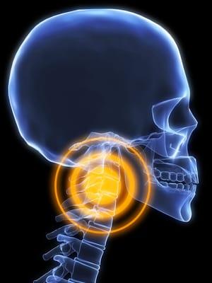 Neck Pain / Whiplash treatment