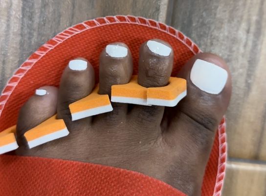 Poorly done  pedicure