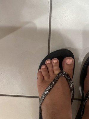 Missing paint on toes