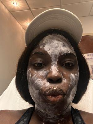 Numbing cream before skinpen treatment