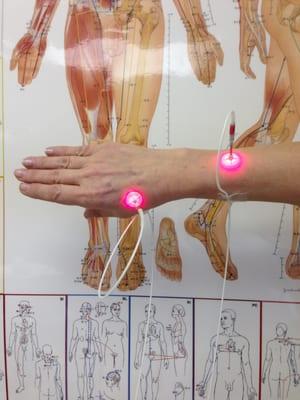 Pain Free Laser Acupuncture