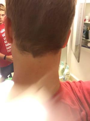 I asked for the neck and back to be cleaned up. Don't remember asking for the starter pack rat tail.