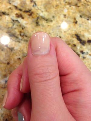 uneven nail polish application