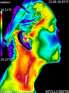 Clinical Thermography is a SAFE no radiation test for early disease prevention