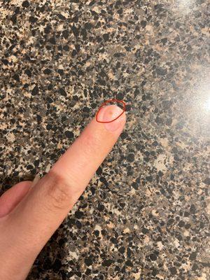 Bacteria growing on nail due to poor application of acrylics