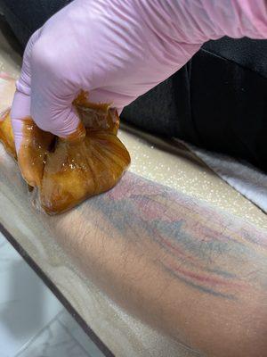 Arm Sugaring