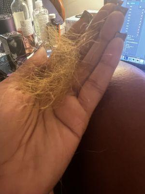 Hair that is dry and sheds! This is just a small insight of what I'm dealing with! This is not normal!