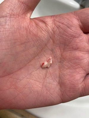 A dog lost a tooth didn't tell owner at all