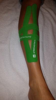 Kinesio Taping Technique used to treat shin splints