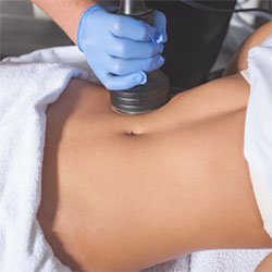 Cryotherapy (cryoslimming, cryotoning, cryofacial)