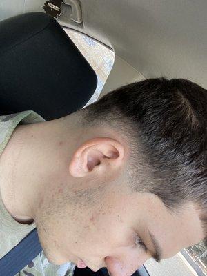 WORST SKIN FADE IN MY LIFE