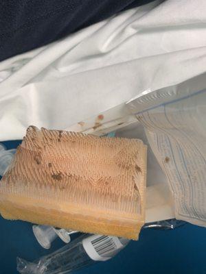 Surgical sponge used to scrub debris from the wound