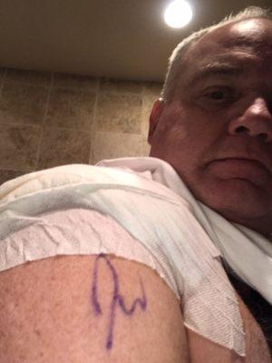 Rotator cuff and tears all fixed up from car accident.