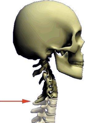 The cervical spine (neck) at 5 ms (milliseconds) after impact.   This may not start hurting for minutes sometime hours.  Get is it checked!