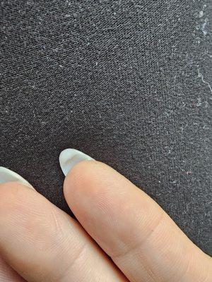 Acrylic under nail multiple were like this