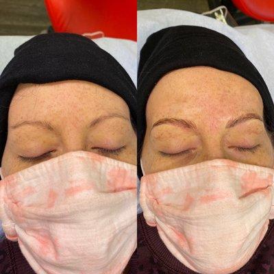 Microblading