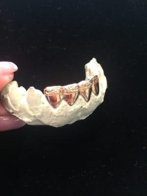 Custom fit 14k yellow gold grills with diamond cut.