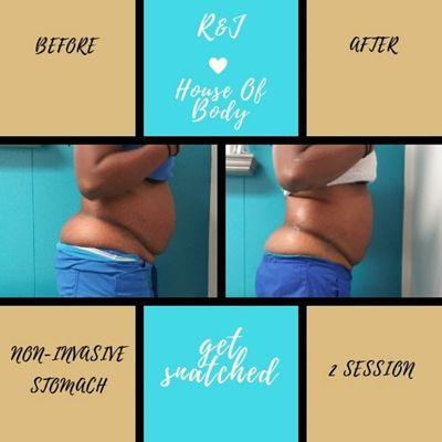 12 sessions

Remove stubborn fat cells