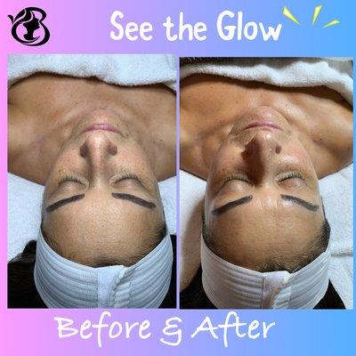 See and feel the Glow! Try Beyond Esthetic's Signature Facial!