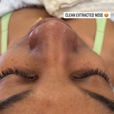 Clean extractions during A Simple Pamper