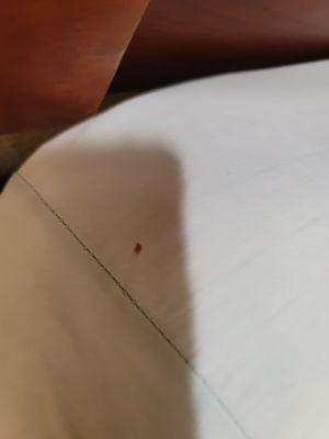 This is blood from a bedbug that I killed, that had just bitten me.