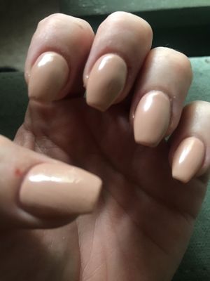 Nails not filled all the way. Cuts on fingers