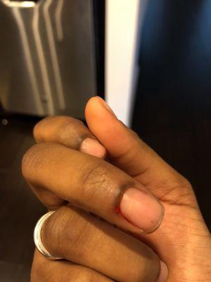 The cut on my middle finger cuticle