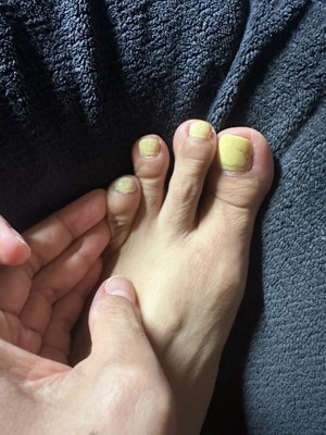 4th toe there are dead skin needs to be cut off. Big toes uneven color painted