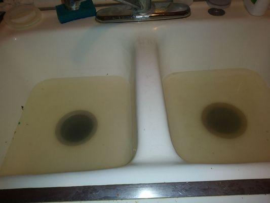 Sinks clogged and stays that way til THEY DECIDE TO FIX IT!