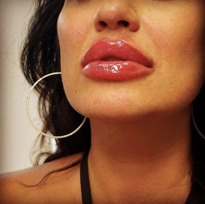 plumped lips!