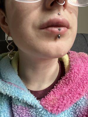 Medusa piercing (not done by this studio, but jewelry switched)