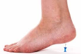 We use Stem Cells for all inflammations of the foot!