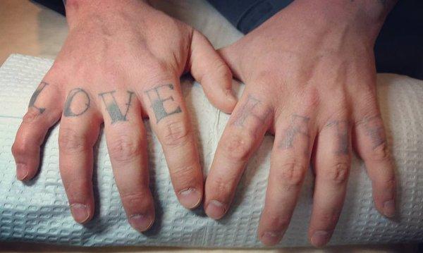 right hand before, left hand 3 sessions. healing beautifully on schedule for removal.( average 3-5 sessions)