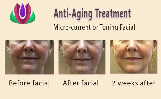 Anti-Aging Treatment - Microcurrent or Toning Facial to lift, tone for sagging skin for a firmed, lifted, youthful complexion.